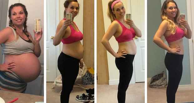 belly post pregnancy